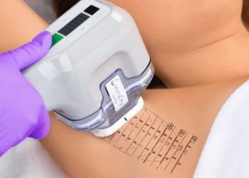 miraDry The Latest Reviews to an Innovative Approach for Underarm Sweat Reduction