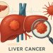 Illustration of liver cancer highlighting early detection and disease awareness concepts